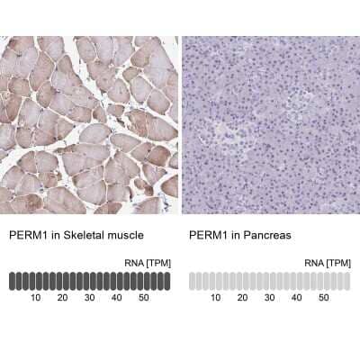 Immunohistochemistry-Paraffin: PERM1 Antibody [NBP1-93520]
