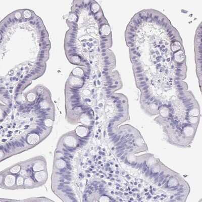 Immunohistochemistry-Paraffin: PERM1 Antibody [NBP1-93520]