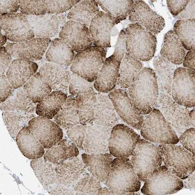 Immunohistochemistry-Paraffin: PERM1 Antibody [NBP2-48616]