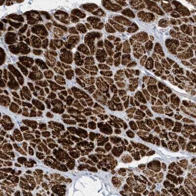 Immunohistochemistry-Paraffin: PERM1 Antibody [NBP2-48616]
