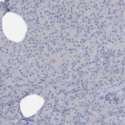 Immunohistochemistry-Paraffin: PERM1 Antibody [NBP2-48616]