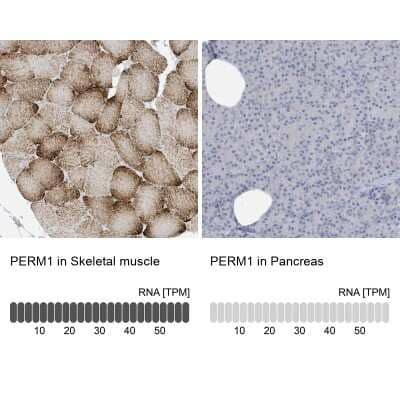Immunohistochemistry-Paraffin: PERM1 Antibody [NBP2-48616]