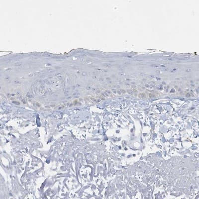 Immunohistochemistry-Paraffin: PERM1 Antibody [NBP2-48616]