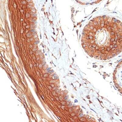 Immunohistochemistry-Paraffin: PERP Antibody (1O3L5) [NBP3-16617]