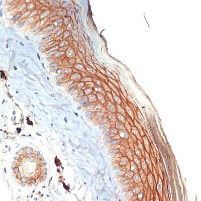 Immunohistochemistry-Paraffin: PERP Antibody (1O3L5) [NBP3-16617]
