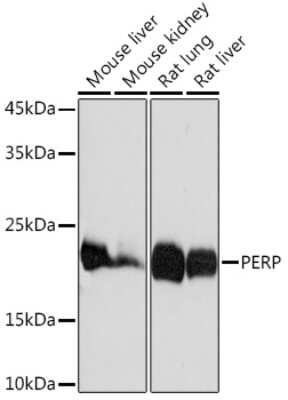 Western Blot: PERP Antibody (1O3L5) [NBP3-16617]