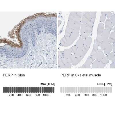 Immunohistochemistry-Paraffin: PERP Antibody [NBP1-85173]
