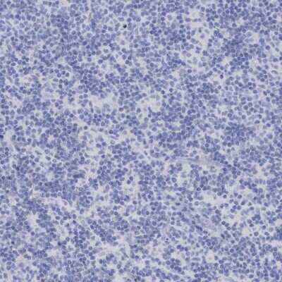 Immunohistochemistry-Paraffin: PERP Antibody [NBP1-85173]