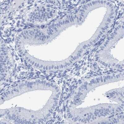 Immunohistochemistry-Paraffin: PERP Antibody [NBP1-85173]