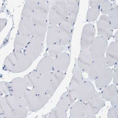 Immunohistochemistry-Paraffin: PERP Antibody [NBP1-85173]