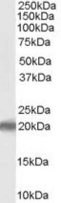 Western Blot: PERP Antibody [NB100-2912]