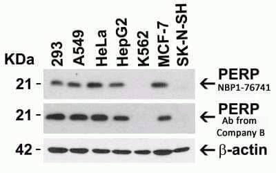 Western Blot: PERP AntibodyBSA Free [NBP1-76741]