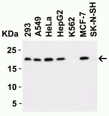 Western Blot: PERP AntibodyBSA Free [NBP1-76741]