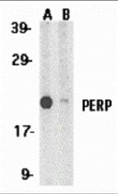 Western Blot: PERP AntibodyBSA Free [NBP1-76741]