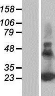 Western Blot: PERP Overexpression Lysate [NBP2-06463]