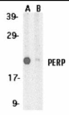 Western Blot: PERP Antibody Blocking Peptide [NBP1-76741PEP]