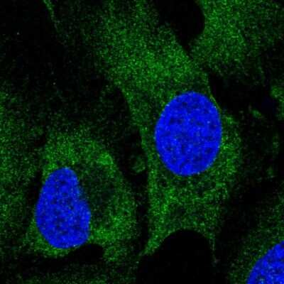 Immunocytochemistry/ Immunofluorescence: PERQ2 Antibody [NBP2-56856]