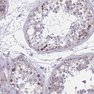 Immunohistochemistry-Paraffin: PERQ2 Antibody [NBP2-34129]