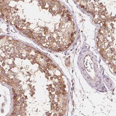 Immunohistochemistry-Paraffin: PERQ2 Antibody [NBP2-56094]