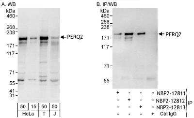 Immunoprecipitation: PERQ2 Antibody [NBP2-12812]