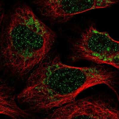 Immunocytochemistry/ Immunofluorescence: PET100 Antibody [NBP2-68853]