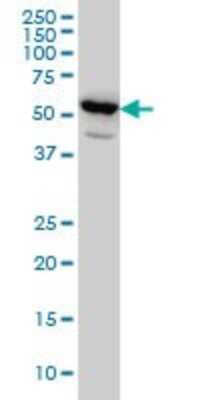 Western Blot: PET112L Antibody (6B2) [H00005188-M01]