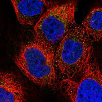 Immunocytochemistry/ Immunofluorescence: PET112L Antibody [NBP1-80925]