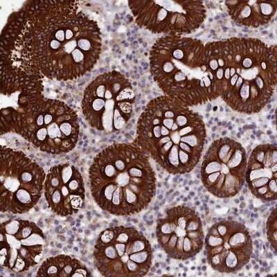 Immunohistochemistry-Paraffin: PET112L Antibody [NBP1-80925]