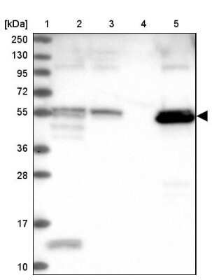 Western Blot: PET112L Antibody [NBP1-80925]