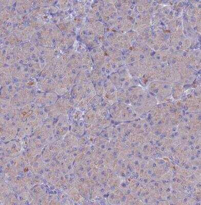 Immunohistochemistry-Paraffin: PET117 Antibody [NBP2-14613]