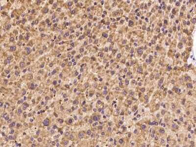 Immunohistochemistry-Paraffin: PET117 Antibody [NBP2-97948]