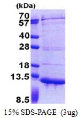 SDS-PAGE: Recombinant Human PET117 His Protein [NBP2-23322]