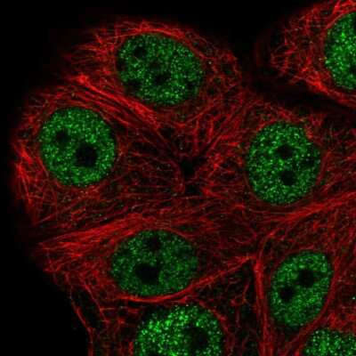 Immunocytochemistry/ Immunofluorescence: PEX10 Antibody [NBP2-58492]