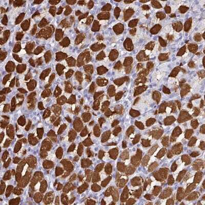 Immunohistochemistry: PEX10 Antibody [NBP2-48945]