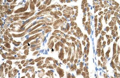 Immunohistochemistry-Paraffin: PEX10 Antibody [NBP1-59745]
