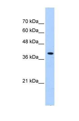 Western Blot: PEX10 Antibody [NBP1-59745]