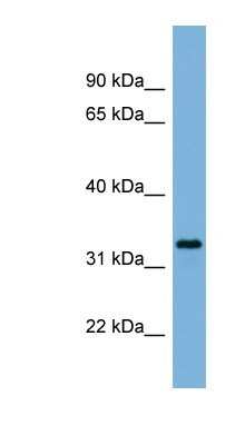 Western Blot: PEX11A Antibody [NBP1-59704]