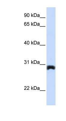 Western Blot: PEX11A Antibody [NBP1-59705]