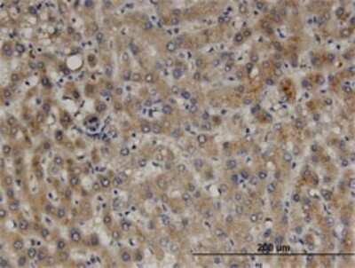 Immunohistochemistry-Paraffin: PEX11B Antibody (2D2) [H00008799-M03]