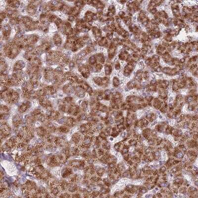 Immunohistochemistry-Paraffin: PEX11B Antibody [NBP2-13750]