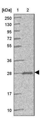 Western Blot: PEX11B Antibody [NBP2-13750]