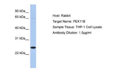 Western Blot: PEX11B Antibody [NBP2-85461]