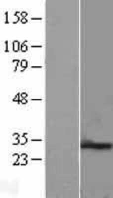 Western Blot: PEX11B Overexpression Lysate [NBL1-14294]