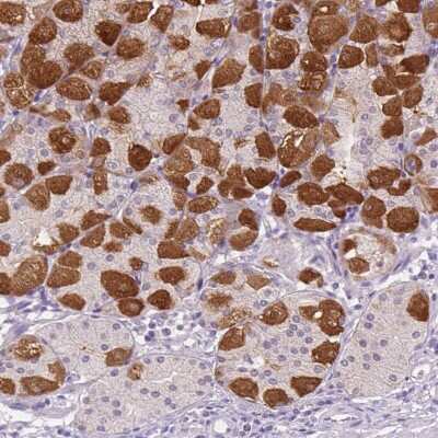 Immunohistochemistry: PEX11G Antibody [NBP2-49620]