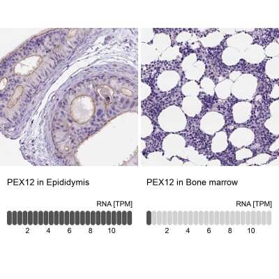 Immunohistochemistry-Paraffin: PEX12 Antibody [NBP2-49599]