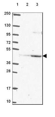 Western Blot: PEX12 Antibody [NBP2-49599]
