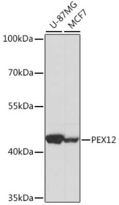 Western Blot: PEX12 AntibodyAzide and BSA Free [NBP2-93666]