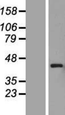 Western Blot: PEX12 Overexpression Lysate [NBL1-14296]