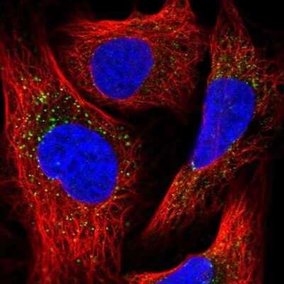 Immunocytochemistry/ Immunofluorescence: PEX13 Antibody [NBP2-38204]