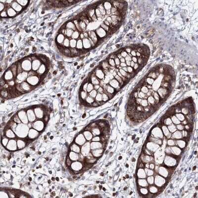 Immunohistochemistry: PEX13 Antibody [NBP2-38204]